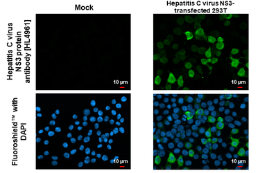 Anti-Hepatitis C virus NS3 protein antibody [HL4961] used in Immunocytochemistry/ Immunofluorescence (ICC/IF). GTX645047
